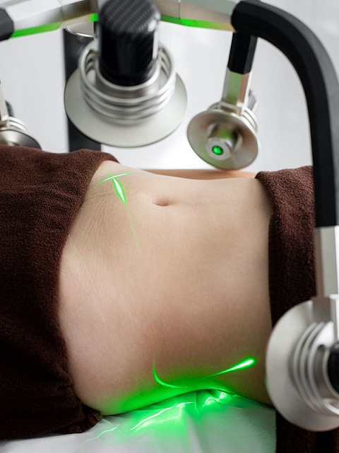 The Benefits of Laser Lipo Machines
